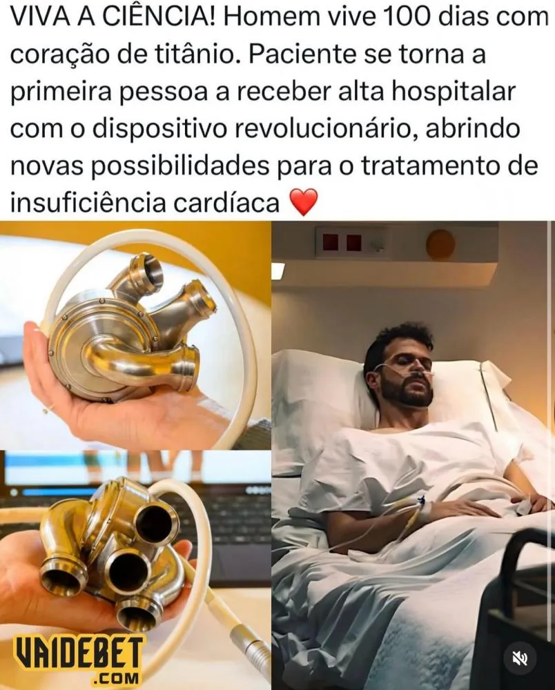 Homem vive 100 dias com coração artificial de titânio enquanto aguarda transplante